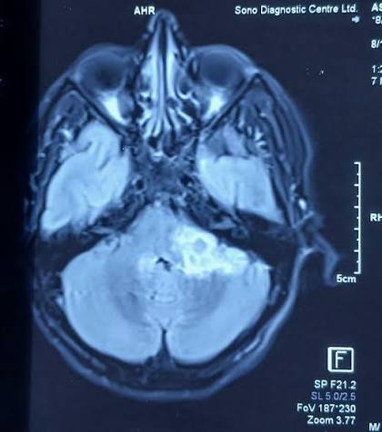 A clinical ear examination image