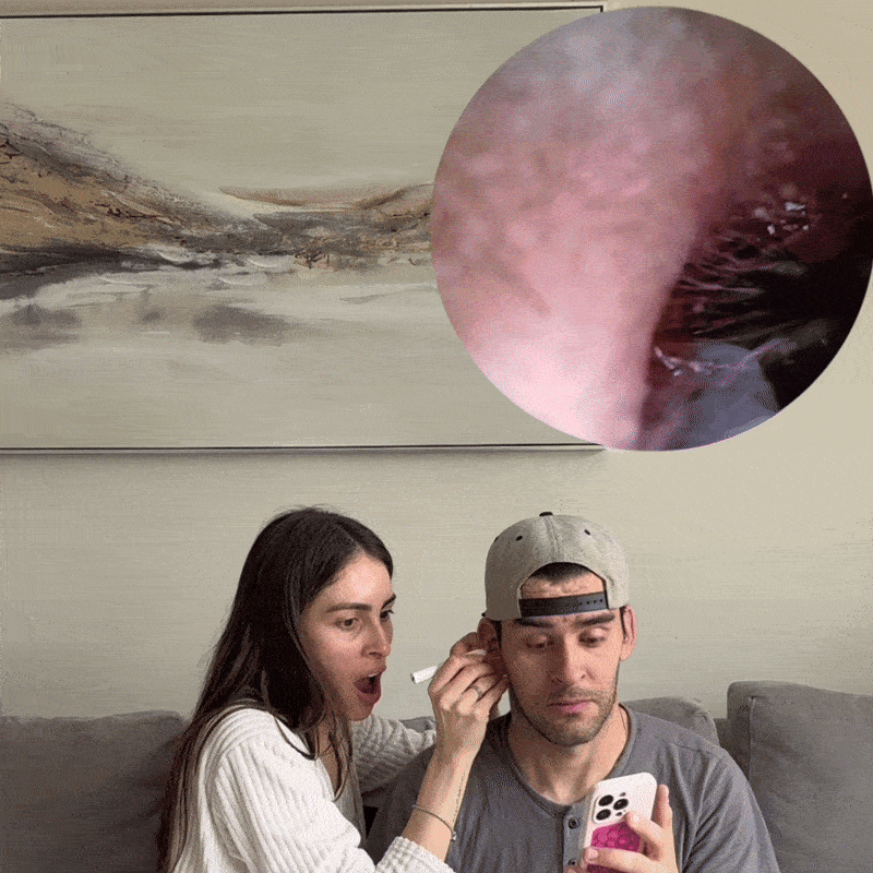 Wax ring around the ear entrance